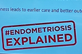 16 May 2026. Inner Wheel Club of Apsaras. Understanding Endometriosis &ndash; A Step Towards Women&rsquo;s Wellness